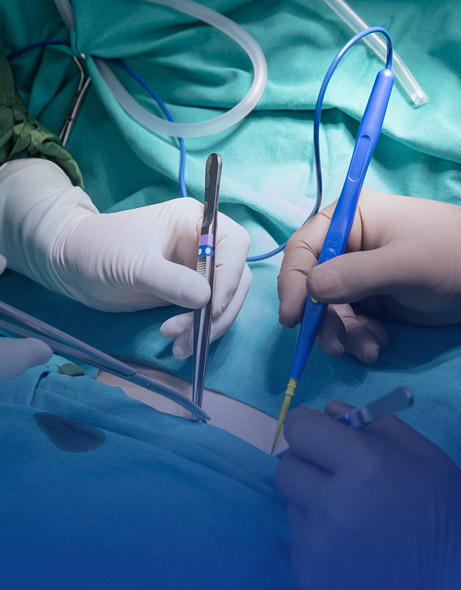 Instrumenta chirurgica